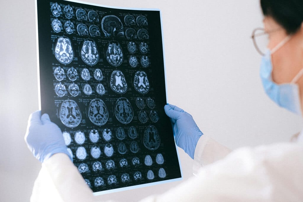 Przyczyny depresji – predyspozycje genetyczne, stres, nieprawidłowości neuroprzekaźników